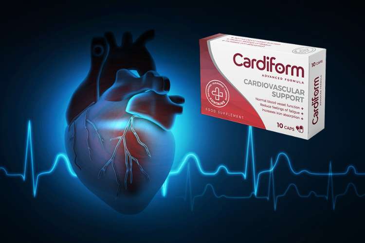 cardiform recensioni